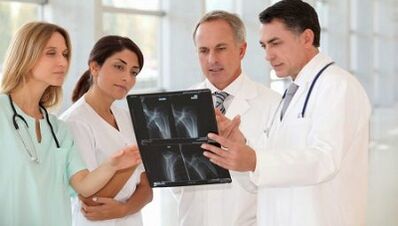 Opcións para a terapia de artrite e artrose